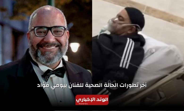 آخر تطورات الحالة الصحية للفنان بيومي فؤاد