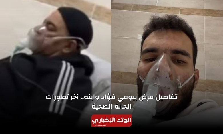 تفاصيل مرض بيومي فؤاد وابنه.. إليك آخر تطورات الحالة الصحية