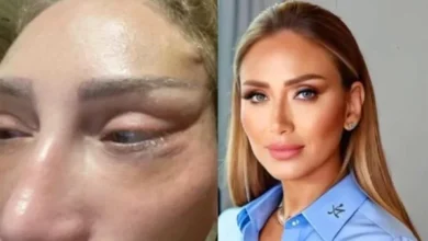 وجه الاعلامية ريهام سعيد بعد عمليات التجيمل