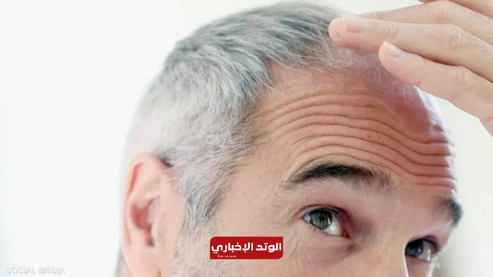 8 أطعمة تؤخر ظهور الشيب المبكر وتحمي الشعر