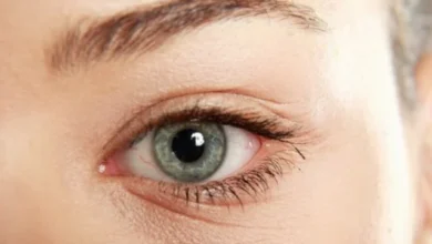 عين أنثى خضراء اللون تعاني من القليل من الجفاف