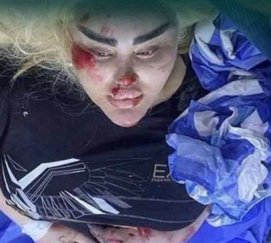 باربي العراقية ويظهر على وجهها علامات الضرب